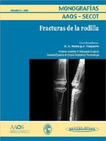 * MONOGRAFÍA: FRACTURAS DE LA RODILLA *
