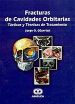 * FRACTURAS DE CAVIDADES ORBITARIAS - TÁCTICAS Y TÉCNICAS DE TRATAMIENTO *