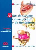 * ATLAS DE CIRUGÍA CRANEOFACIAL Y DE HENDIDURAS - VOL.1: CIRUGÍA CRANEOFACIAL *