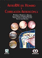 * ARTRORM DEL HOMBRO Y CORRELACIÓN ARTROSCÓPICA *