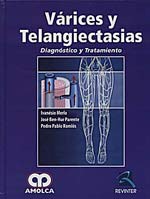 * VÁRICES Y TELANGIECTASIAS - DIAGNÓSTICO Y TRATAMIENTO *