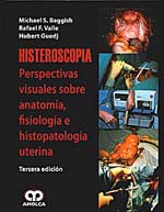 * HISTEROSCOPIA - PERSPECTIVAS VISUALES DE LA ANATOMÍA, FISIOLOGÍA E HISTOPATOLOGÍA UTERINA *