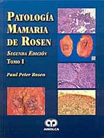 * PATOLOGÍA MAMARIA DE ROSEN *