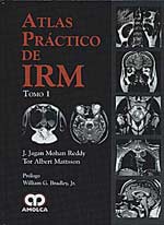 * ATLAS PRÁCTICO DE IRM *