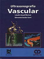 * ULTRASONOGRAFÍA VASCULAR *
