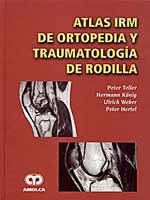 * ATLAS IRM DE ORTOPEDIA Y TRAUMATOLOGÍA DE RODILLA *