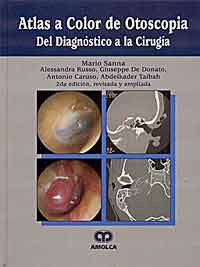 * ATLAS A COLOR DE OTOSCOPIA DEL DIAGNÓSTICO A LA CIRUGÍA *