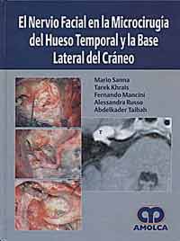 * EL NERVIO FACIAL EN LA MICROCIRUGÍA DEL HUESO TEMPORAL Y LA BASE LATERAL DEL CRÁNEO *