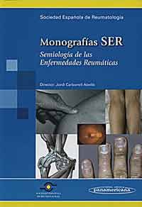 * MONOGRAFÍAS SER - SEMIOLOGÍA DE LAS ENFERMEDADES REUMÁTICAS *