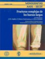 * MONOGRAFÍA: FRACTURAS COMPLEJAS DE LOS HUESOS LARGOS *