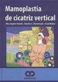 * MAMOPLASTIA DE CICATRIZ VERTICAL *