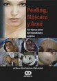 * PEELING, MÁSCARA Y ACNÉ - SUS TIPOS Y PASOS DEL TRATAMIENTO ESTÉTICO *
