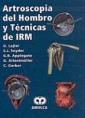 * ARTROSCOPIA DEL HOMBRO Y TÉCNICAS DE IRM *