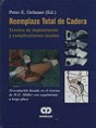 * REEMPLAZO TOTAL DE CADERA - TÉCNICA DE IMPLANTACIÓN Y COMPLICACIONES LOCALES *