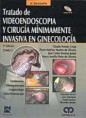 * TRATADO DE VIDEOENDOSCOPIA Y CIRUGÍA MÍNIMAMENTE INVASIVA EN GINECOLOGÍA + DVDS *